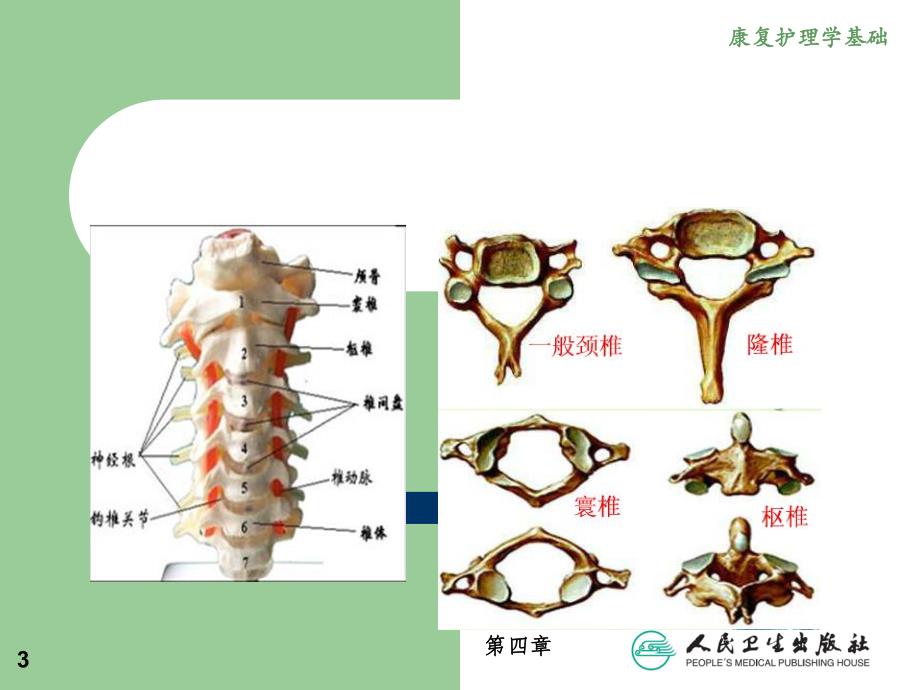 颈椎病康复护理.ppt_第3页