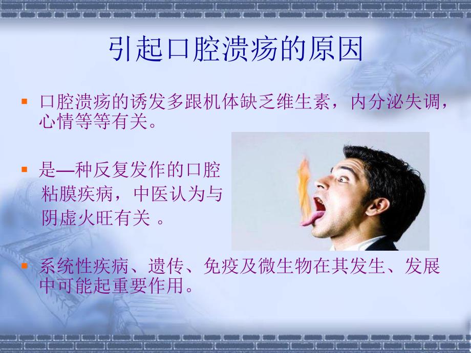 口腔溃疡ppt.ppt_第2页