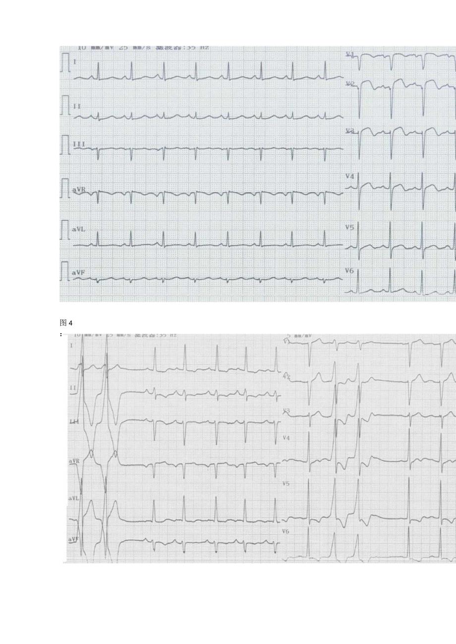 心电图阅图试题14题及答案.docx_第3页