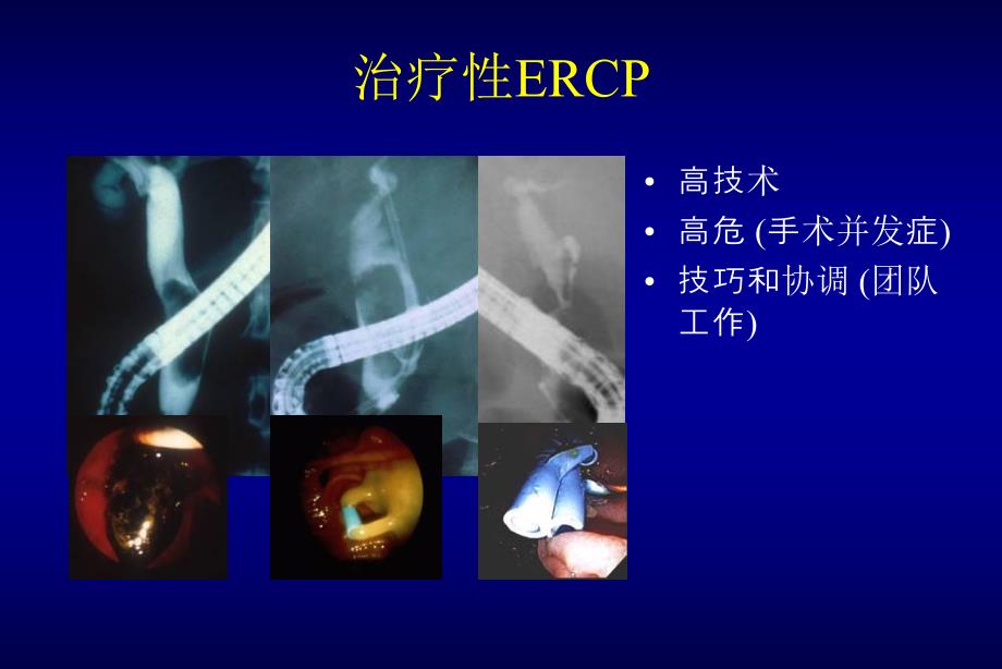 ERCP的规范化培训.ppt_第2页