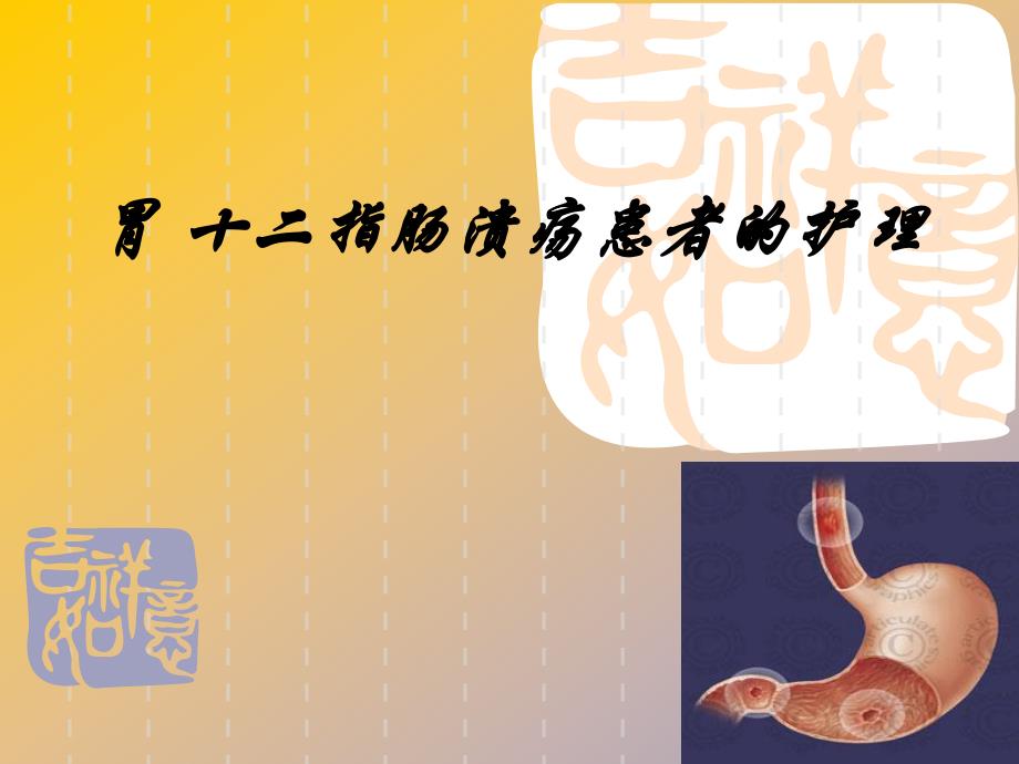 胃十二指肠溃疡.ppt_第1页