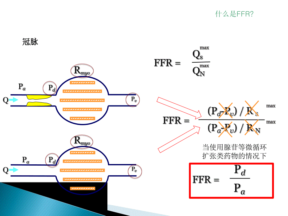 FFR临床应用.ppt_第3页