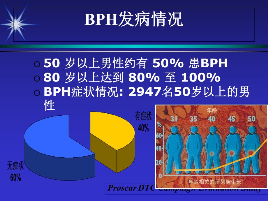 BPH诊断与鉴别诊断 cases.ppt_第3页