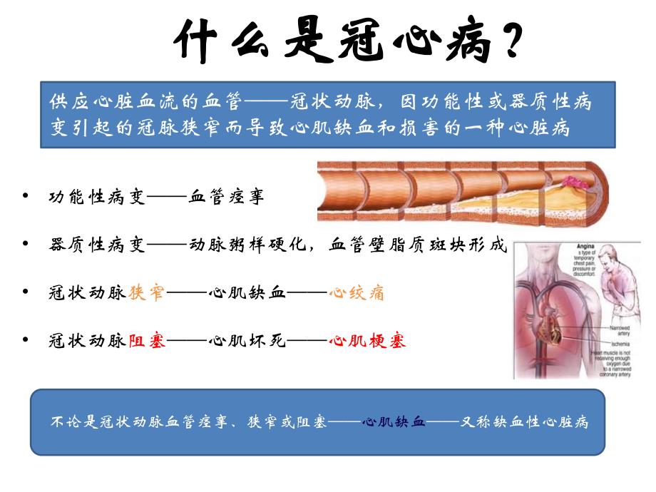 冠心病的防治教学课件.ppt_第2页