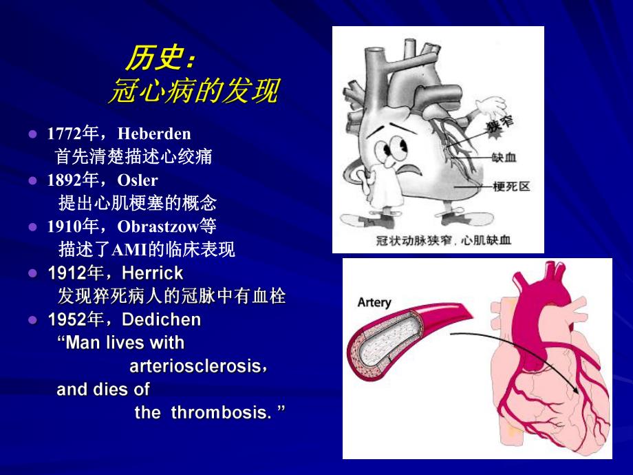 冠心病的介入治疗.ppt_第2页