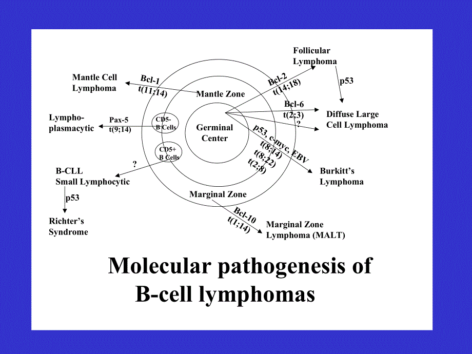 B淋巴细胞增殖性疾病鉴别诊断.ppt_第3页