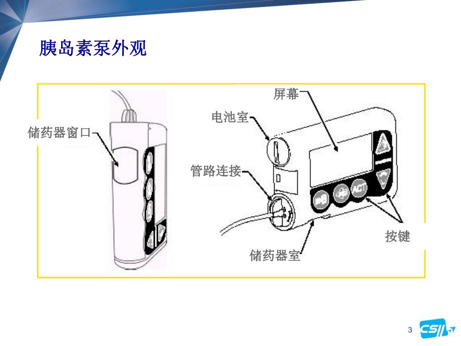 [临床医学]712胰岛素泵的操作.ppt_第3页