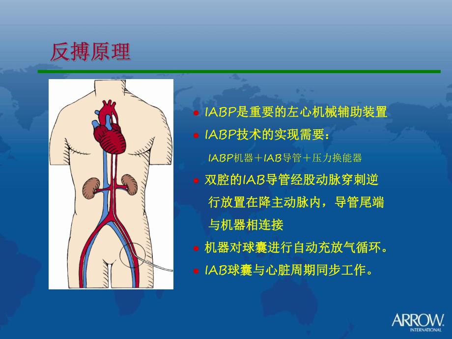 IABPAutocat 2.ppt_第2页