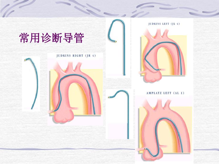 冠心病介入基础知识.ppt.ppt_第2页