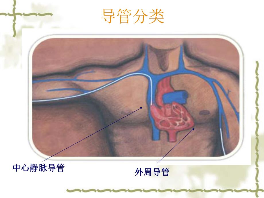 静脉输液工具的选择及维护.ppt_第3页