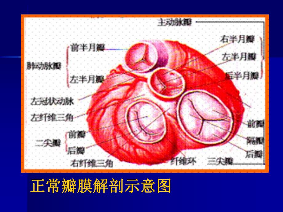 第四节风心病.ppt_第2页