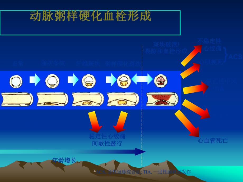 冠心病健康教育幻灯片.ppt_第3页