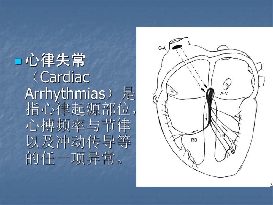 第5节心律失常名师编辑PPT课件.ppt_第2页