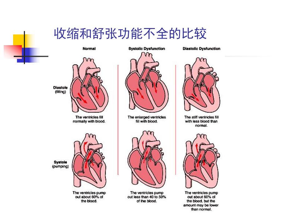 心力衰竭诊断及治疗新进展.ppt_第3页