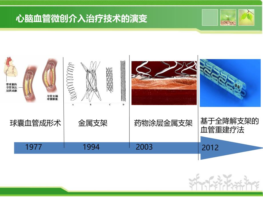 生物可降解血管支架的研究现状.ppt_第3页