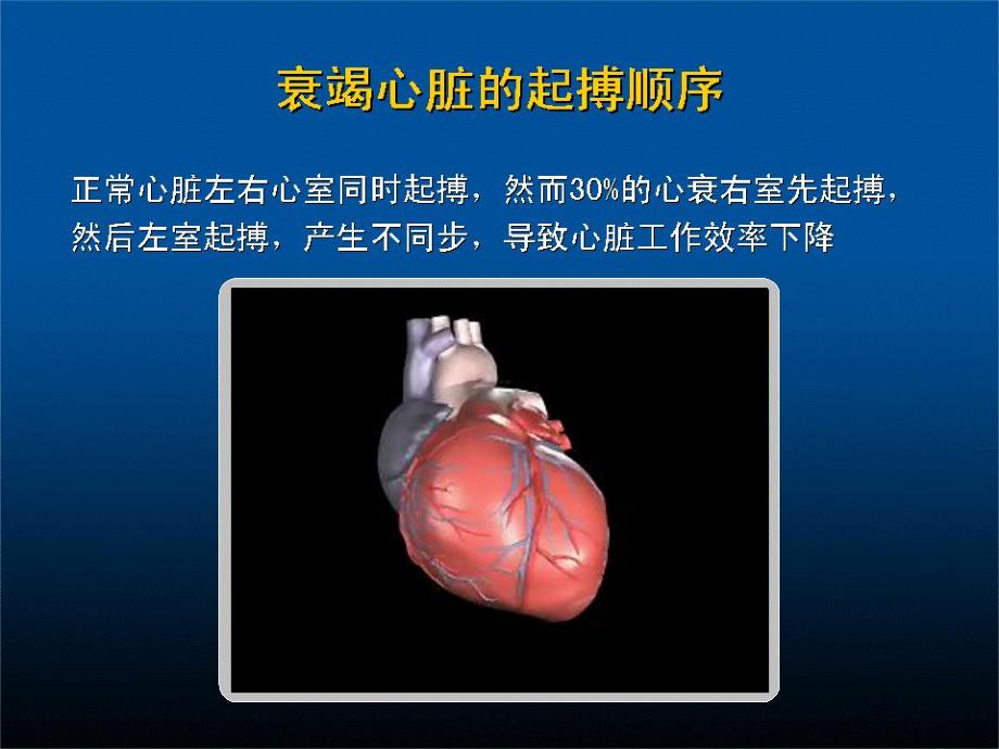 心脏再同步治疗.ppt_第3页