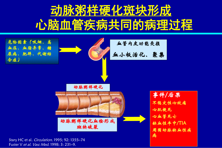 环氧化酶抑制剂在心脑血管疾病的临床应用研究修改.ppt_第3页