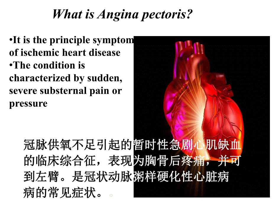 抗心绞痛药.ppt_第3页