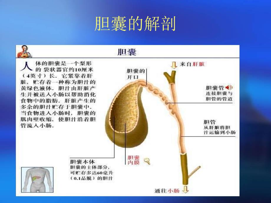 急性胆囊炎.ppt_第3页