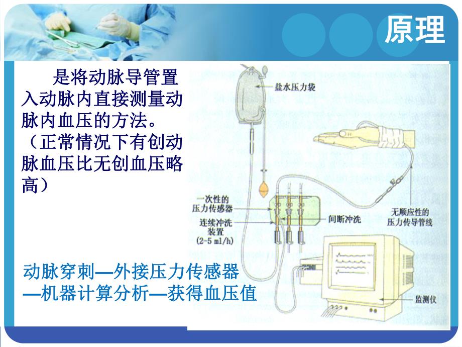 有创血压监测abmn.ppt_第3页