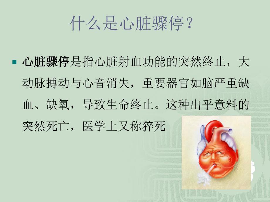 术中心脏骤停应急预案.ppt_第2页