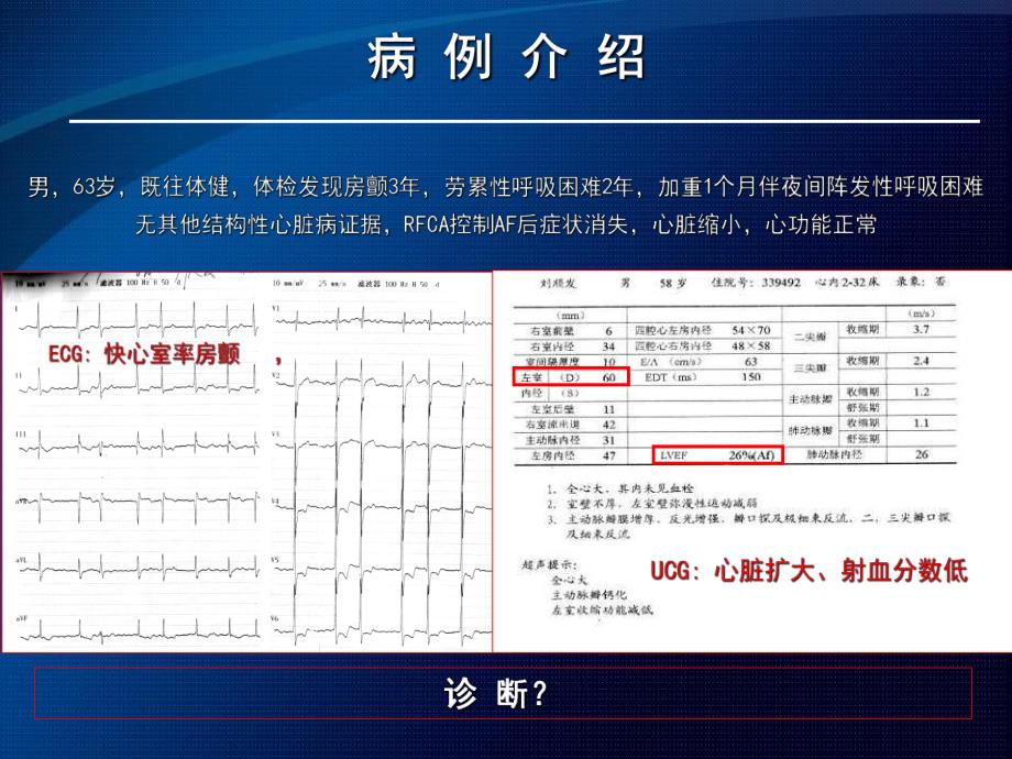 心律失常性心肌病.ppt.ppt_第2页