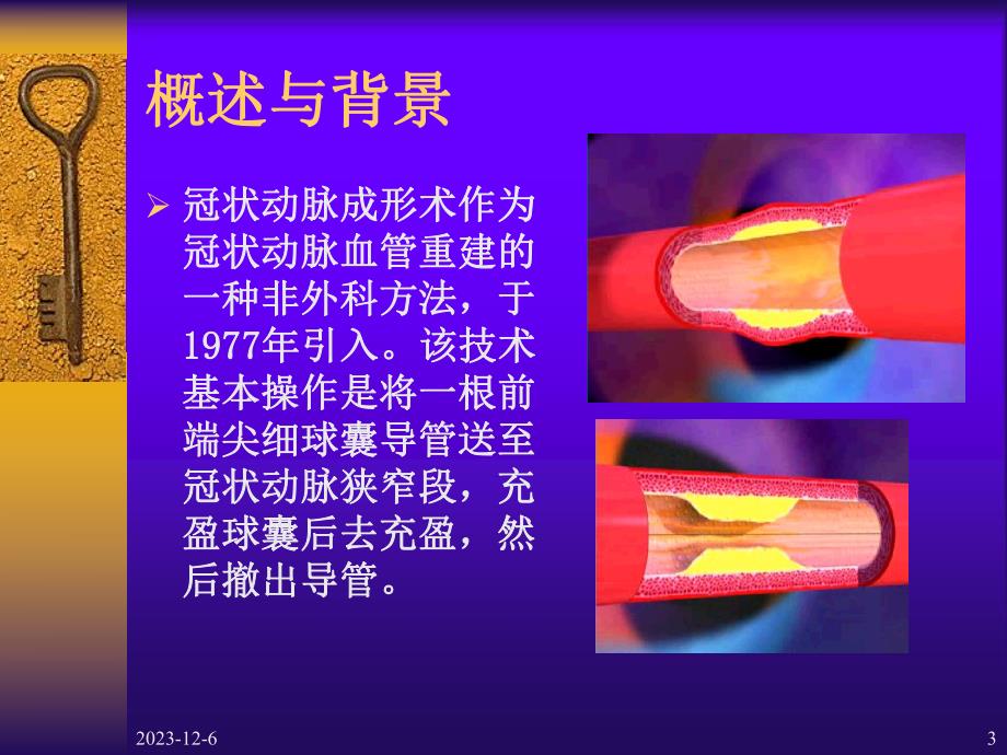 心血管疾病介入诊断治疗护理.ppt_第3页