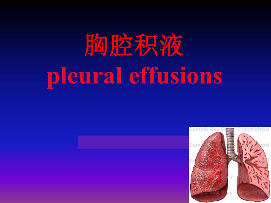 胸腔积液.ppt_第1页