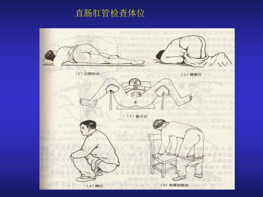 结、直肠与肛门疾病疾病上海第二医科大学[最新].ppt_第2页