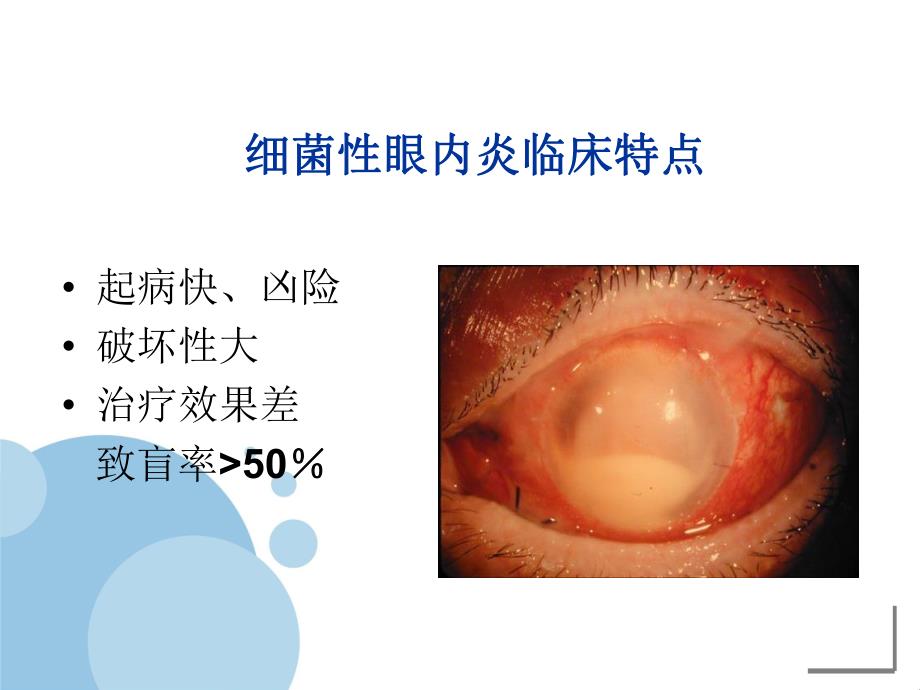 白内障术中预防细菌性眼内炎的意识和策略.ppt_第2页