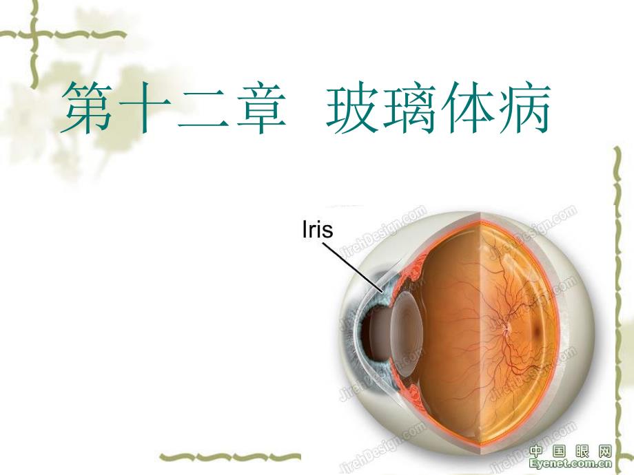 第十二章 玻璃体病.ppt_第1页