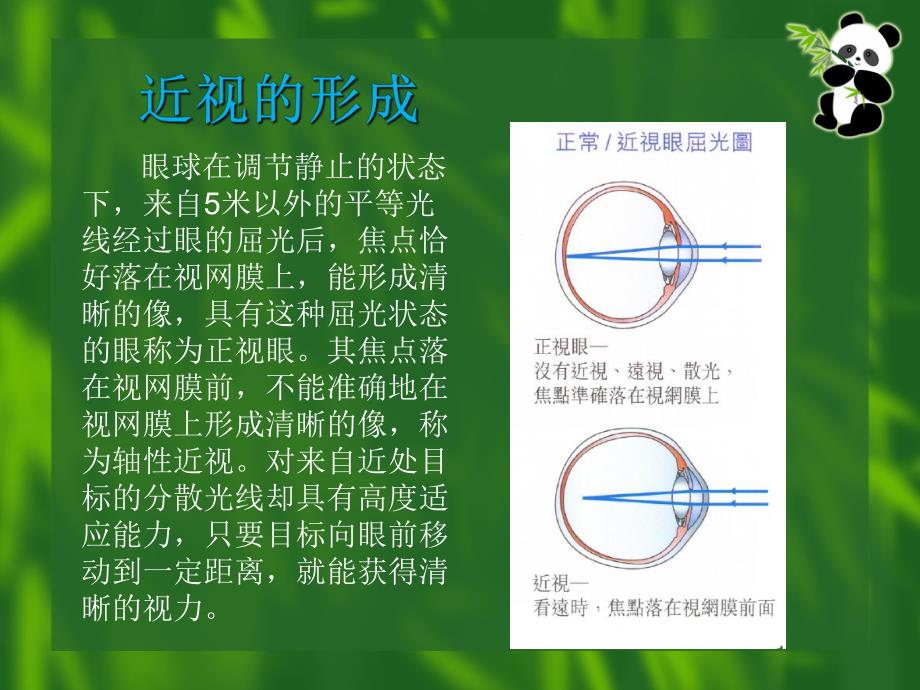 近视眼的防治1.ppt_第2页