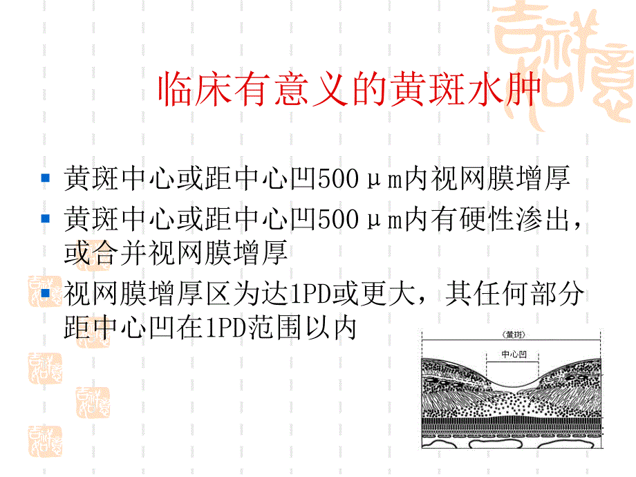 糖尿病性黄斑水肿.ppt_第3页