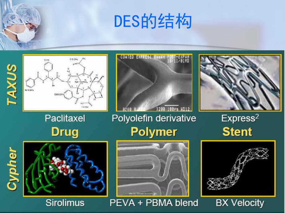 药物洗脱支架操作要点.ppt_第2页