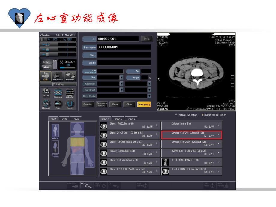 CT左心室功能成像.ppt_第3页