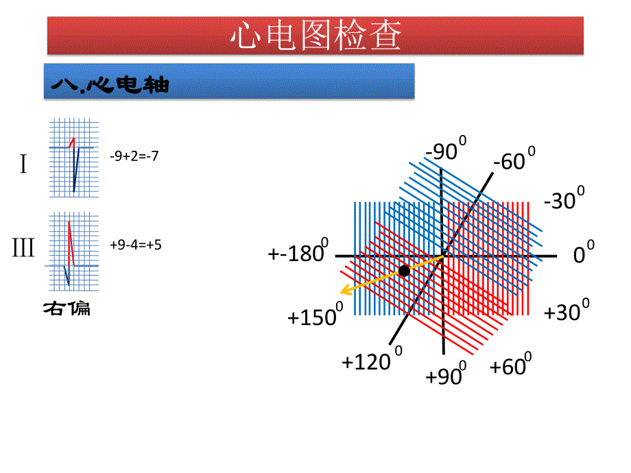 心电图检查.ppt_第1页