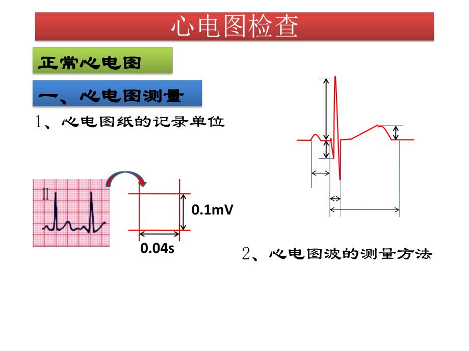 心电图检查.ppt_第2页