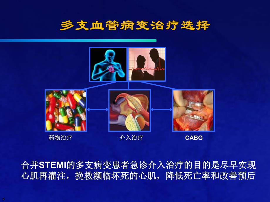 合并多支血管病变的STEMI介入治疗策略.ppt_第2页