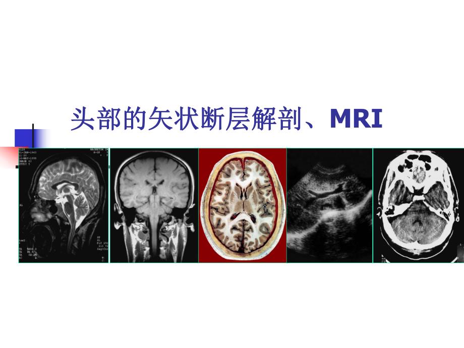 头部的矢状断层解剖应用.ppt_第1页