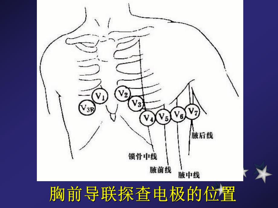 心电图幻灯片内一科[优质文档].ppt_第2页