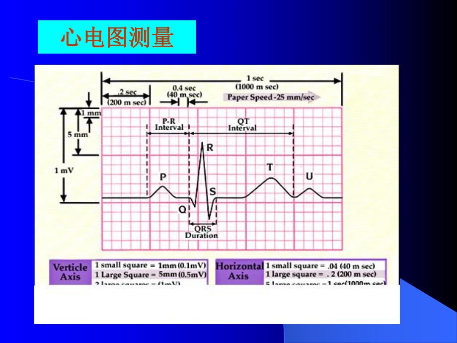 心电图岗前培训PPT幻灯片.ppt_第3页