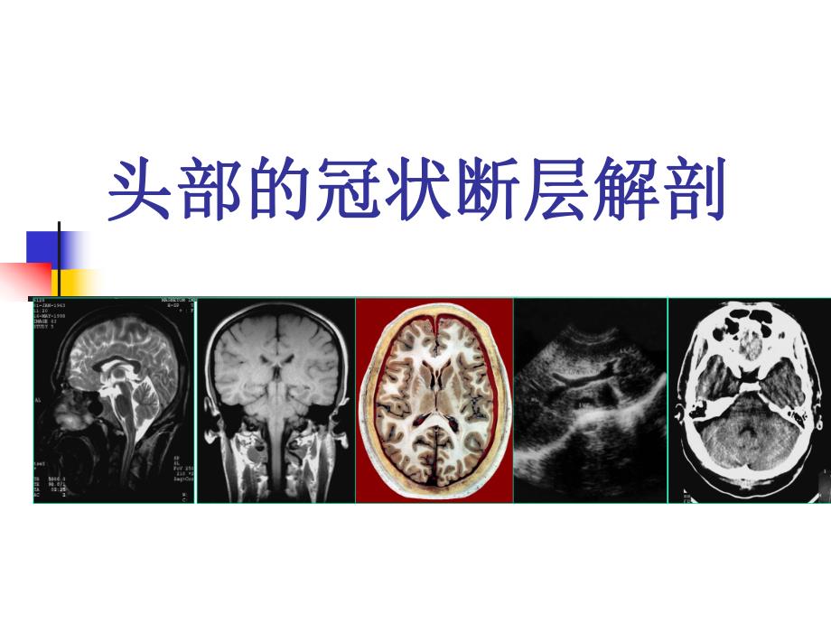 头部的冠状断层解剖应用.ppt_第1页