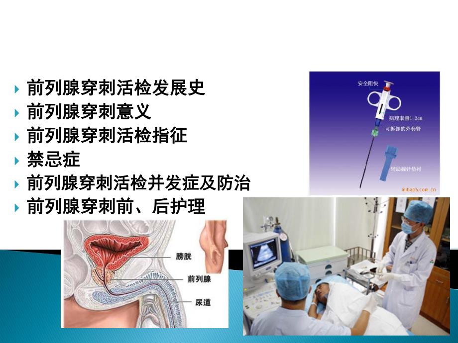 前列腺穿刺活检.ppt_第2页