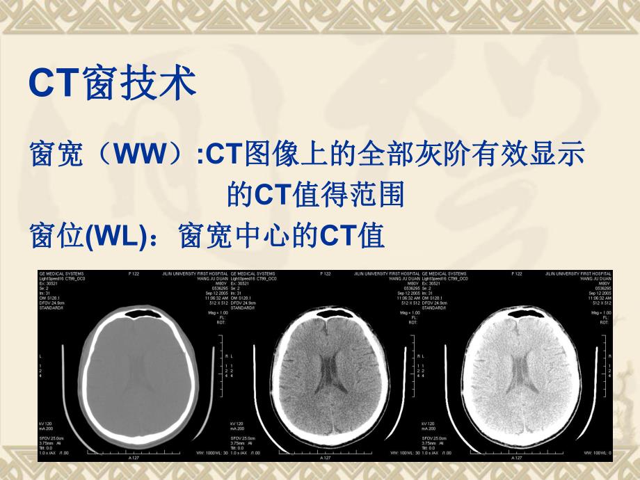 头部CT基础及断面解剖.ppt_第3页