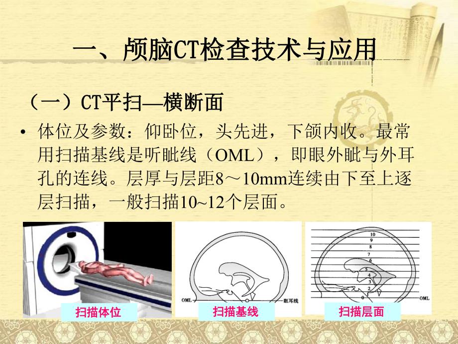 CT检查技术的临床应用.ppt_第3页