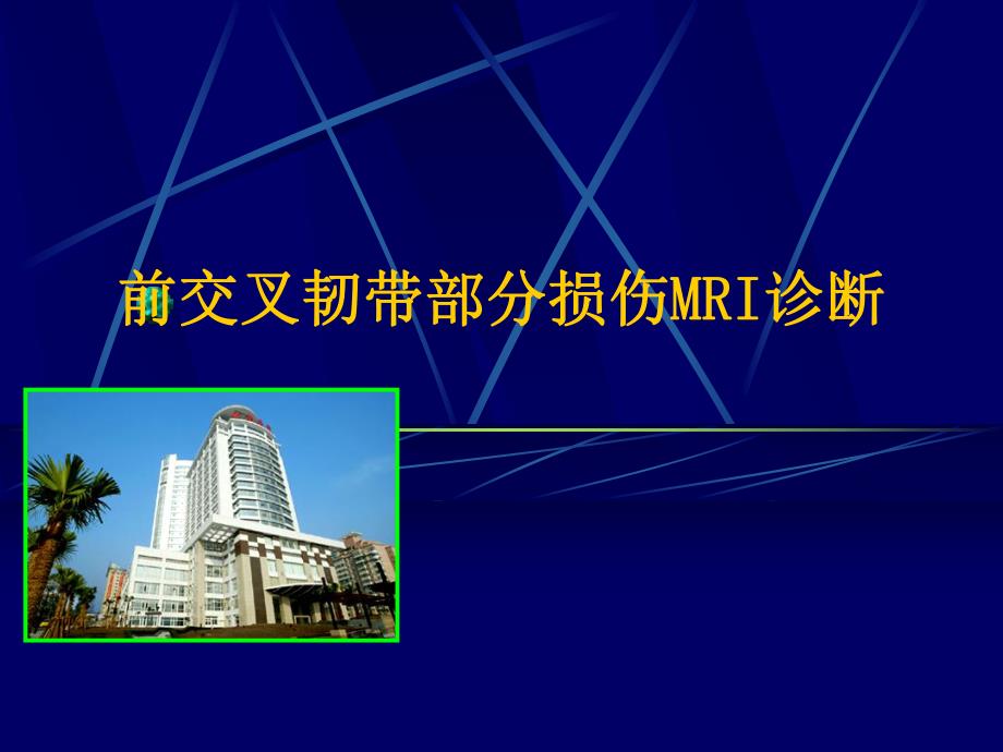 前交叉韧带部分损伤MRI诊断.ppt_第1页