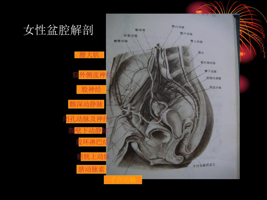 子宫肌瘤CT影像分析.ppt_第2页