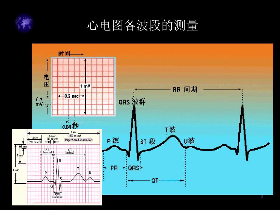 心电图入门精要..ppt_第3页