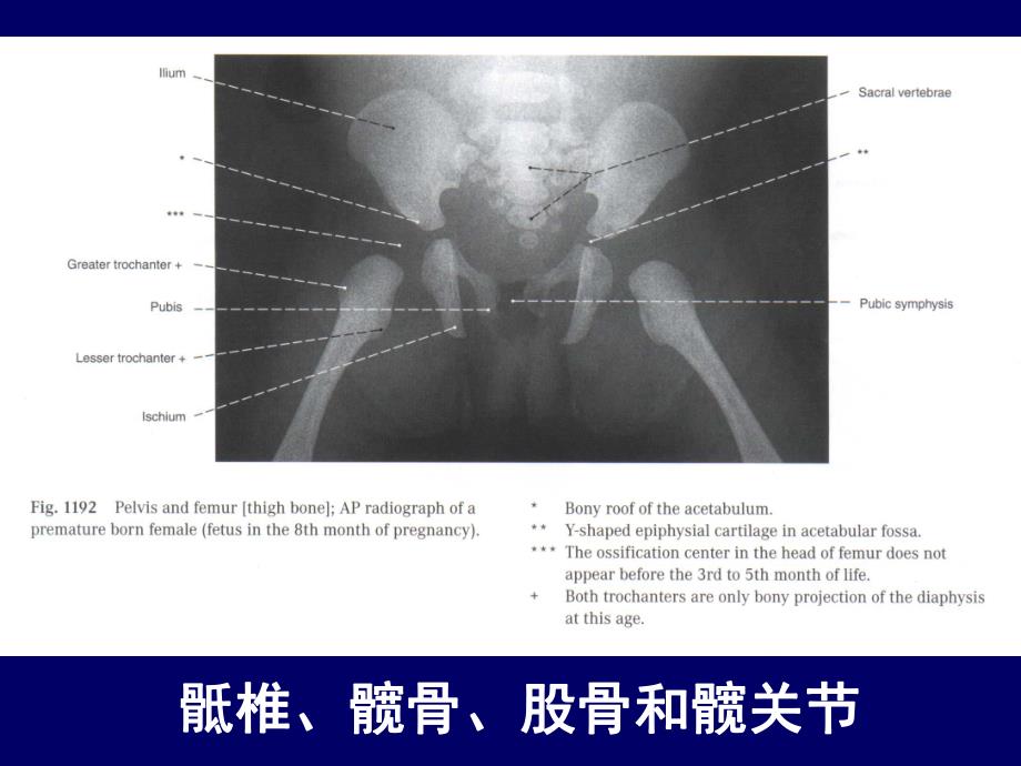 人体断层解剖学、下肢断层解剖.ppt_第3页