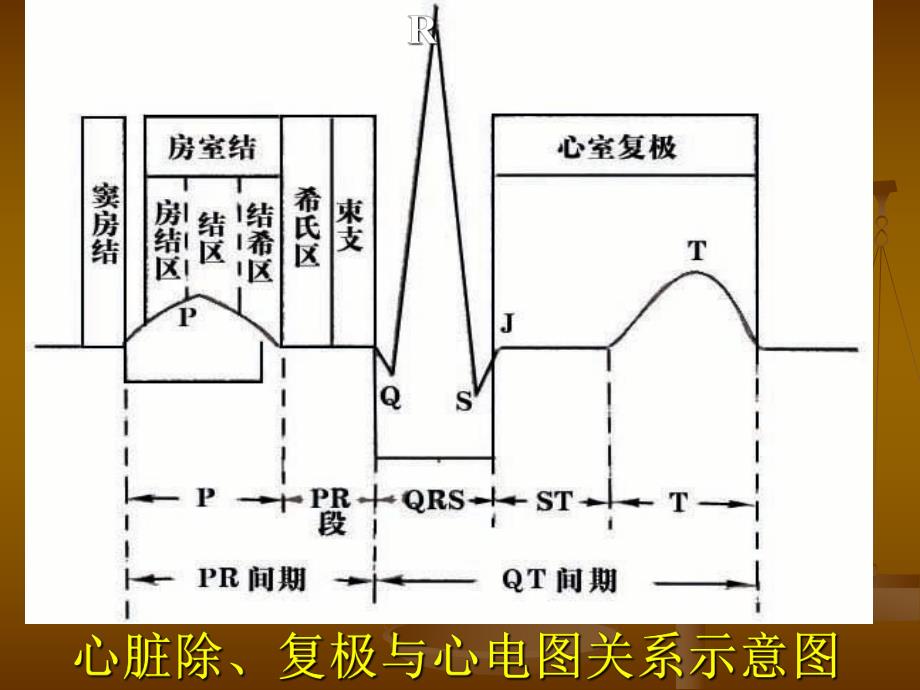 快速心电图入门.ppt_第3页